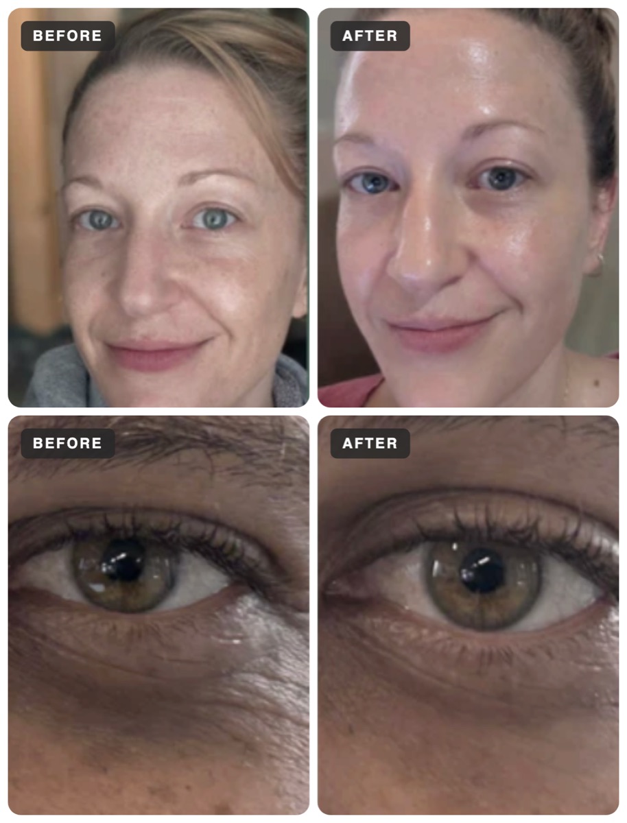 Customer photos, before and after