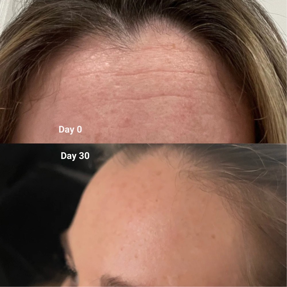Customer photos, day 0 and day 30