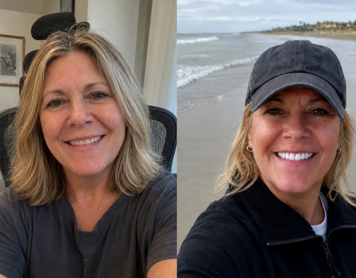 The same smile on day 1 and day 7